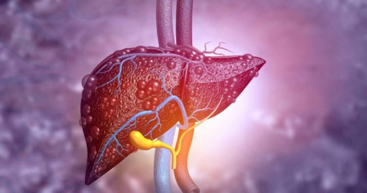 Como as doenças hepáticas se manifestam: os primeiros sintomas de danos aos órgãos são nomeados