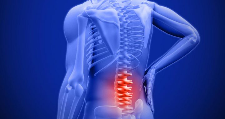 Como distinguir a dor da doença renal da dor lombar: aspectos importantes nomeados