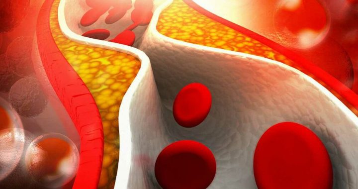 Produto muito saboroso reduz colesterol: médicos dizem que é preciso consumi-lo com mais frequência